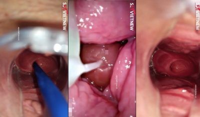 Cận Cảnh Nội Soi Lồn Em Rau Sạch Và Xuất Tình Vào Trong