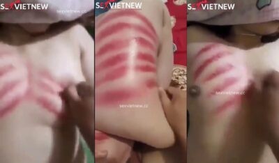Chàng rể may mắn giúp mẹ vợ cạo gió và cái kết